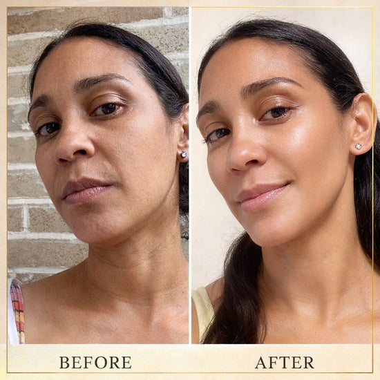 Before: Dull appearance, low confidence, and lack of comfort in daily routine.