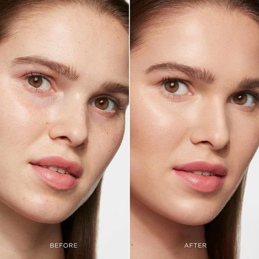 Before: Skin appears tired, lackluster, and uneven, with reduced radiance and visible dryness.